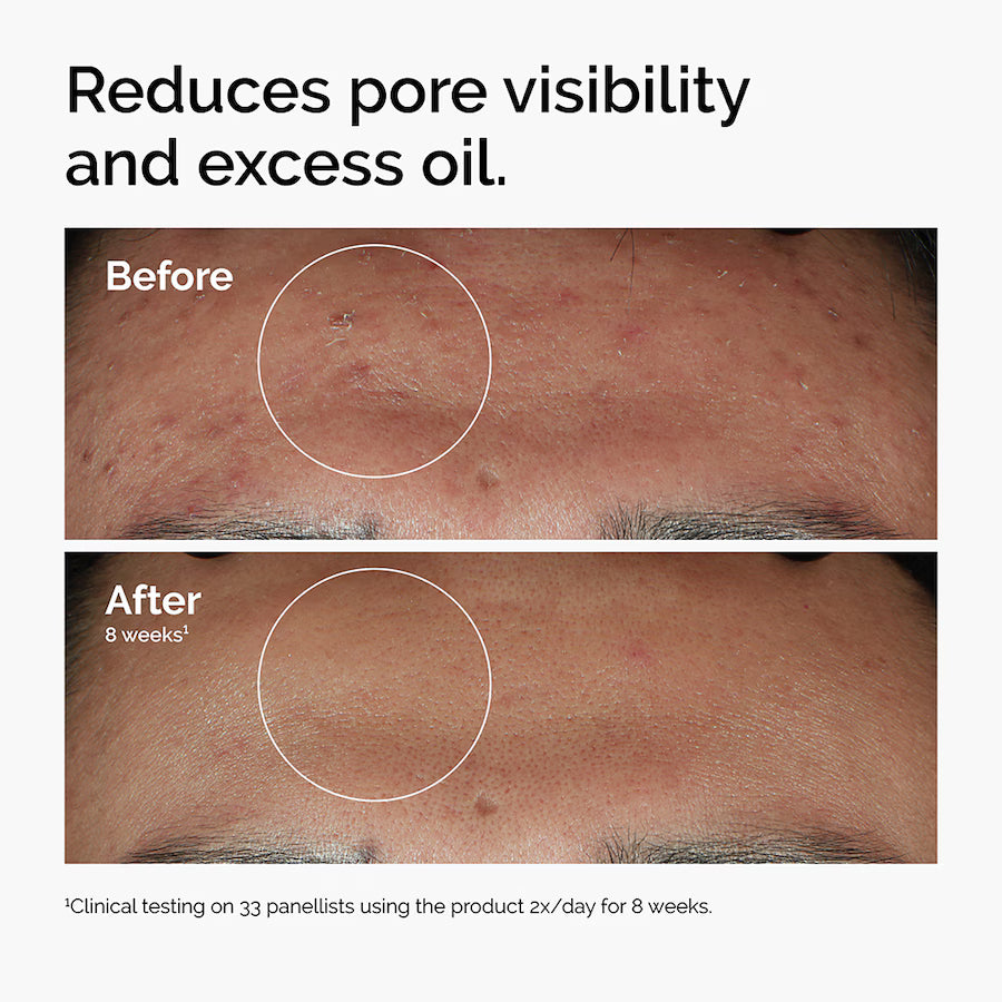 The Ordinary More Molecules Niacinamide 10% + Zinc 1%